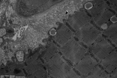 5x5 MIA 23,000x Muscle