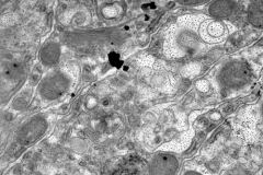 Coral Tissue 25,000x