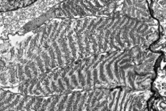 Muscles cell of a worm