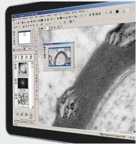 Integration in iTEM and Radius - TEM Imaging Platforms