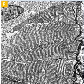 Muscle cell of a worm