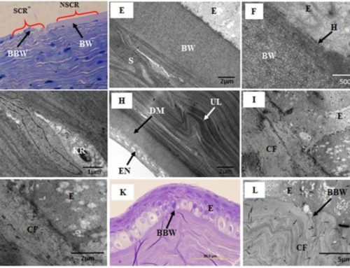 EMSIS camera helps in research of Keratoconus