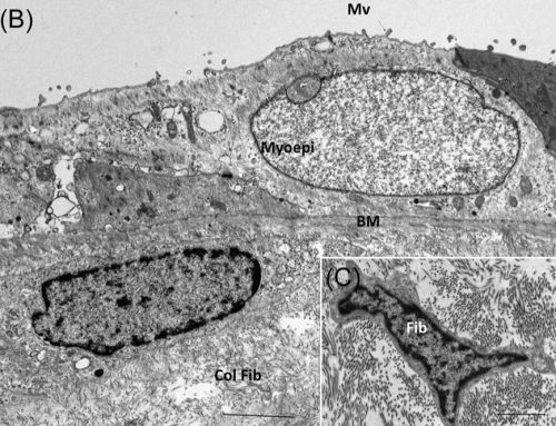 EMSIS camera helps in Meniere disease research